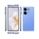 https://storage.alifshop.tj/media/images/alifshop/18264/tecno-camon-20-8-256-gb-siniy-1754642816244-xs.webp