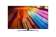https://storage.alifshop.tj/media/images/alifshop/35172/televizor-lg-smart-tv-uhd-ai-ut81-4k-75ut81-75ut81009lb-75-dyuym-1752033369630-xs.webp