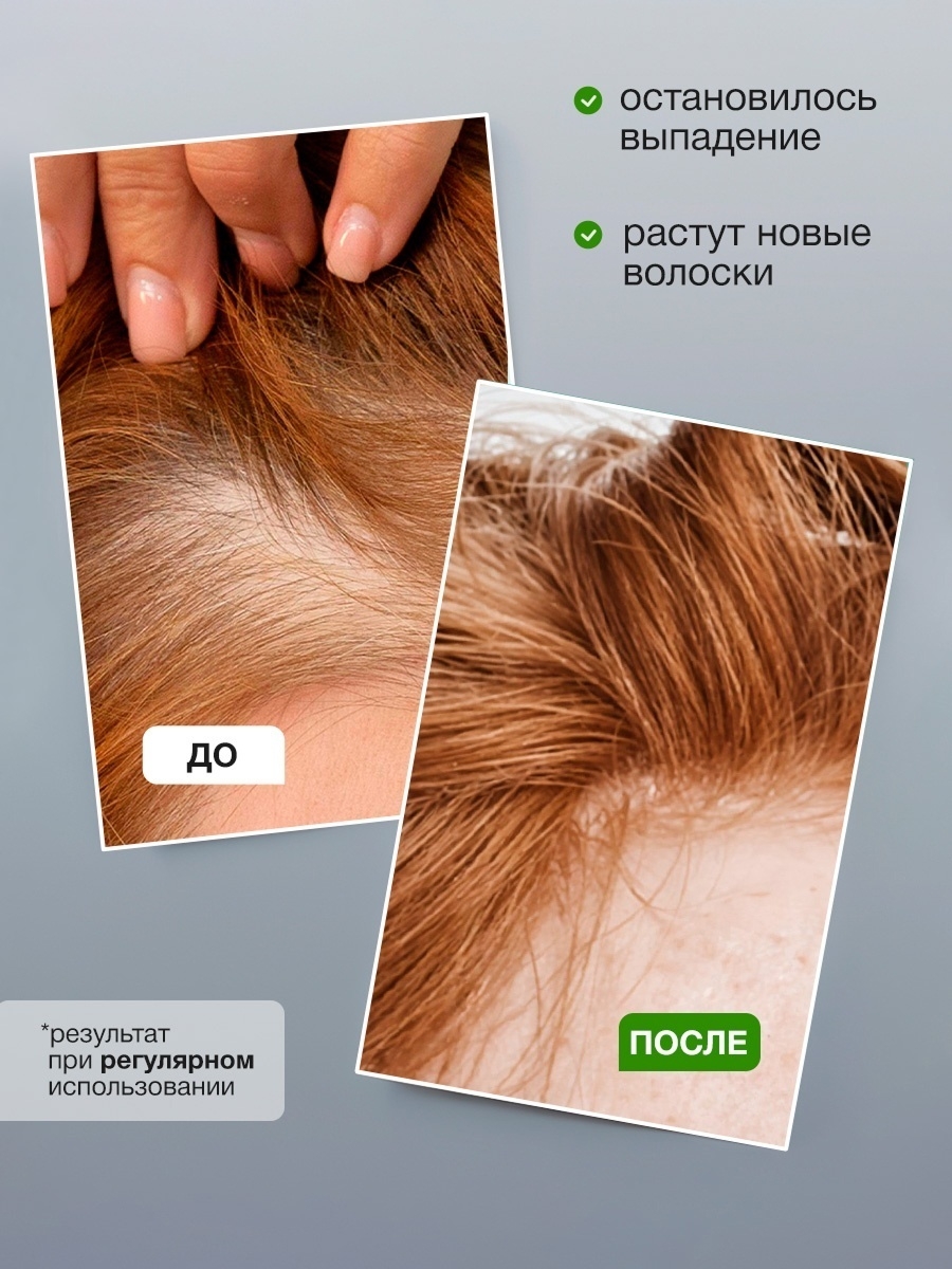 https://storage.alifshop.tj/media/images/alifshop/55844/shampun-dlya-volos-stimulation-tashe-professional-300-ml-1776245964309.jpg
