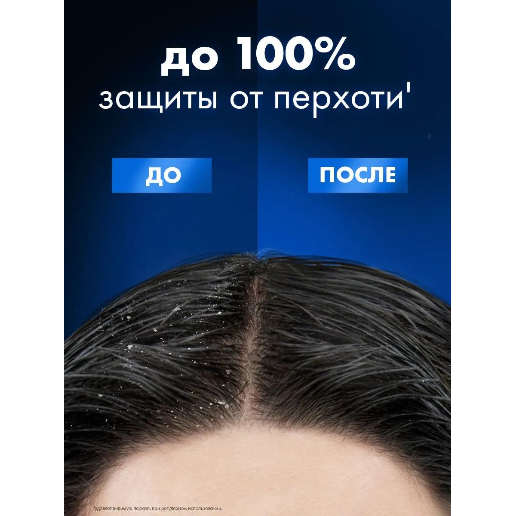 https://storage.alifshop.tj/media/images/alifshop/57743/shampun-kliar-men-3v1-chistota-i-svezhest-650-ml-1779282015917.png