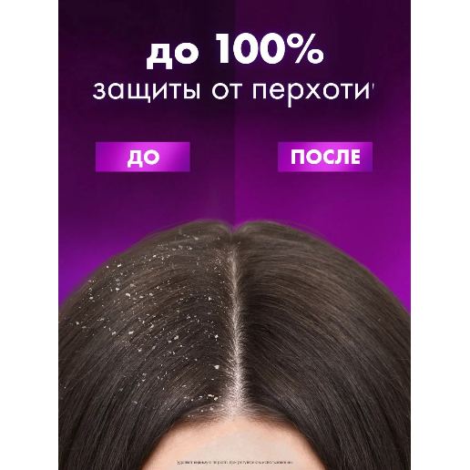 https://storage.alifshop.tj/media/images/alifshop/57752/shampun-kliar-protiv-perhoti-vosstanovlenie-povrezhdennyh-i-okrashennyh-volos-650-ml-1779338317093.png