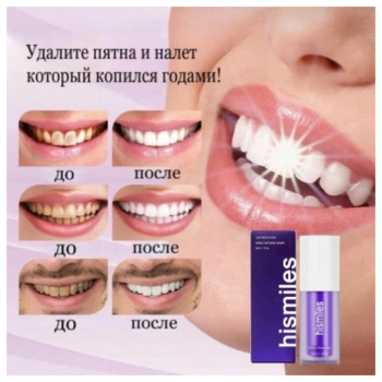 https://storage.alifshop.tj/media/images/alifshop/70990/zubnaya-pasta-lg-perioe-total-advanced-160-g-copy-1793354535956-l4xD7dBd-lg.webp